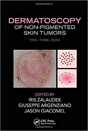 Dermatoscopy of Non-Pigmented Skin Tumors:Pink - Think - Blink 2015 By Iris Zalaudek