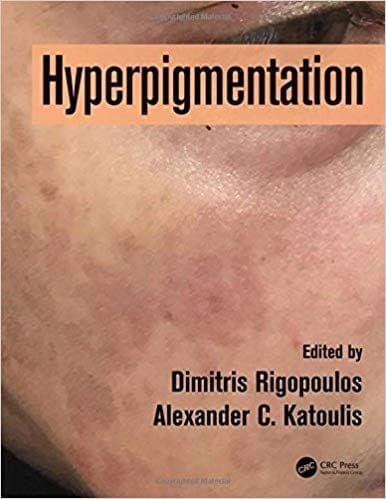 Hyperpigmentation 2017 By  Dimitris Rigopoulos