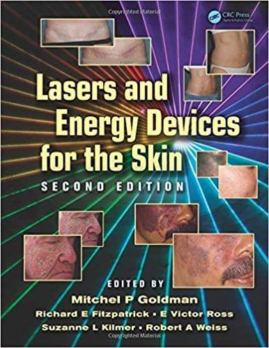 Lasers and Energy Devices for the Skin 2013 By Mitchel P. Goldman