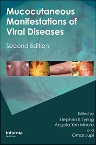 Mucocutaneous Manifestations of Viral Diseases: An Illustrated Guide to Diagnosis and Management 2010 By Stephen Tyring