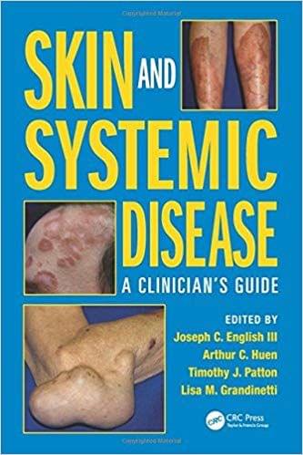 Skin and Systemic Disease: A Clinician?s Guide 2015 By Joseph C. English III