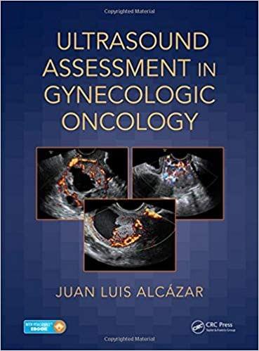 Ultrasound Assessment in Gynecologic Oncology 2018 By Juan Luis Alc?zar