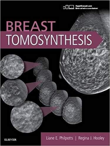 Breast Tomosynthesis 1st Edition 2016 By Breast Tomosynthesis