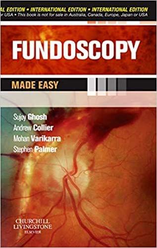 Fundoscopy Made Easy, International Edition 2010 By Ghosh