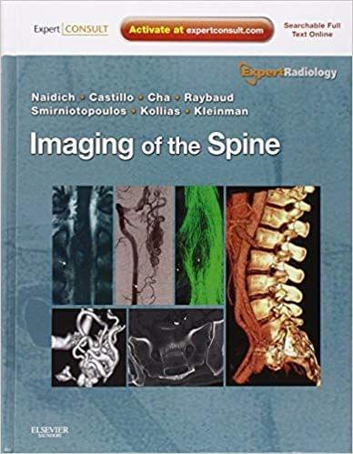 Imaging of the Spine  2010 By Thomas P. Naidich