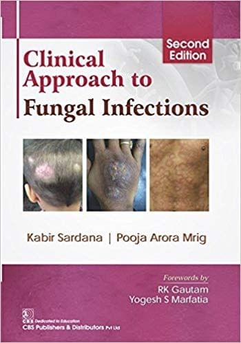 Clinical Approach To Fungal Infections 2nd Edition 2018 By Sardana K