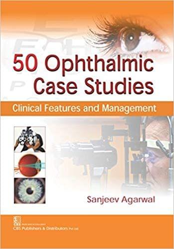 50 Ophthalmic Case Studies Clinical Features And Management 2018 By Agarwal S.