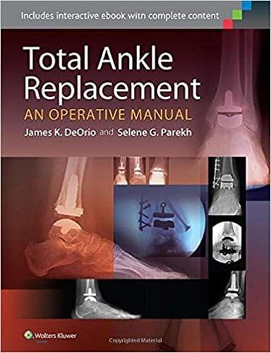 Total Ankle Replacement: An Operative Manual 2014 By  James K. DeOrio