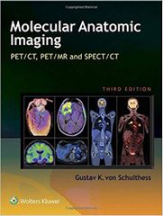 Molecular Anatomic Imaging: PET/CT, PET/MR and SPECT CT 2015 By Gustav K. Von Schulthess