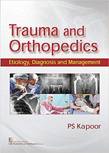 Trauma And Orthopedics Etiology Diagnosis And Management 2017 By Kapoor