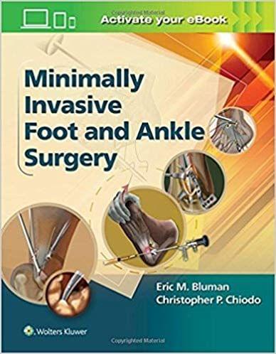 Minimally Invasive Foot And Ankle Surgery (Hb 2016) 1st Edition By bluman