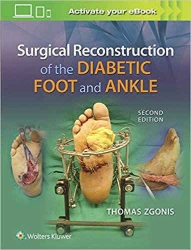 Surgical Reconstruction of the Diabetic Foot and Ankle 2nd Edition By Thomas Zgonis