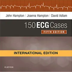 150 Ecg Cases International Edition 5th edition 2019 By John Hampton