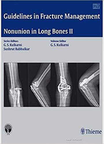 Guidelines in Fracture Management-Nonunion in Long Bones II 2016 By Sushrat Babhulkar
