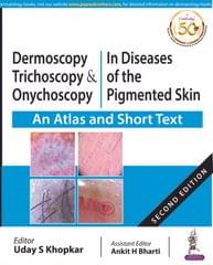 Dermoscopy, Trichoscopy & Onychoscopy  In Diseases of the Pigmented Skin 2nd Edition 2020 By Uday S Khopkar