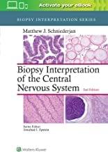 Biopsy Interpretation of the Central Nervous System