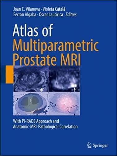 Atlas of Multiparametric Prostate MRI 2018 By Joan C. Vilanova