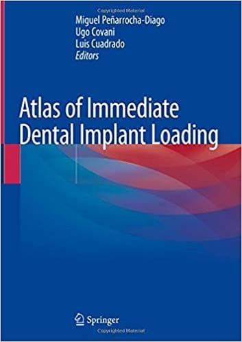 Atlas of Immediate Dental Implant Loading 2019 By Miguel Pe??arrocha-Diago