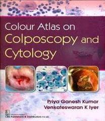 Colour Atlas on Colposcopy and Cytology By Priya Ganesh Kumar