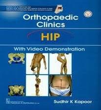 Orthopaedic Clinics HIP with Video Demonstration By Sudhir K Kapoor