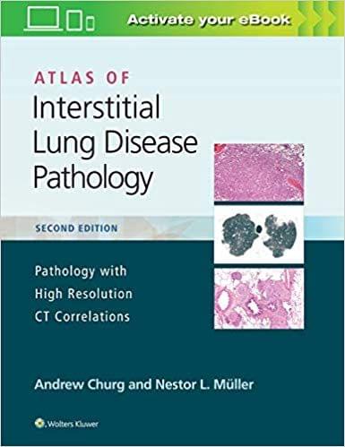 Atlas of Interstitial Lung Disease Pathology 2019 By Andrew Churg