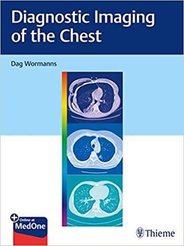 Diagnostic Imaging of the Chest 1st Edition 2020 By Dag Wormanns