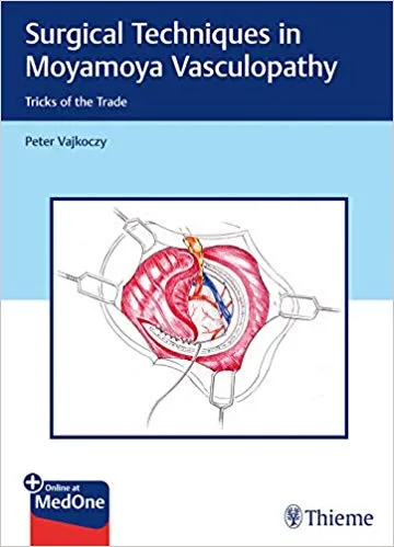 Surgical Techniques in Moyamoya Vasculopathy: Tricks of the Trade 2020 By Peter Vajkoczy
